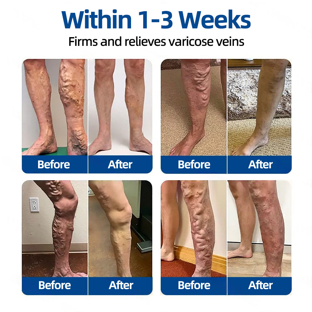 👙 ✅𝐅𝐥𝐨𝐫𝐢𝐬𝐦𝐚®🐋🐋 𝐕𝐞𝐢𝐧𝐓𝐚𝐫𝐠𝐞𝐭 𝐌𝐢𝐜𝐫𝐨𝐧𝐞𝐞𝐝𝐥𝐞 𝐏𝐚𝐭𝐜𝐡⚡Instant Relief, Long-Term Results