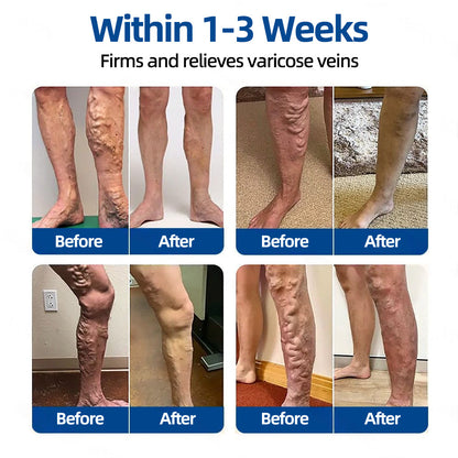 👙 ✅𝐅𝐥𝐨𝐫𝐢𝐬𝐦𝐚®🐋🐋 𝐕𝐞𝐢𝐧𝐓𝐚𝐫𝐠𝐞𝐭 𝐌𝐢𝐜𝐫𝐨𝐧𝐞𝐞𝐝𝐥𝐞 𝐏𝐚𝐭𝐜𝐡⚡Instant Relief, Long-Term Results