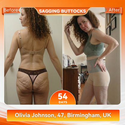 🧧✨PAURAJU® 30-Min All-in-One Micro-Particle Fat-Burning Shorts✅Ignites deep microcirculation to melt fat, flush toxins, and reverse metabolic aging.