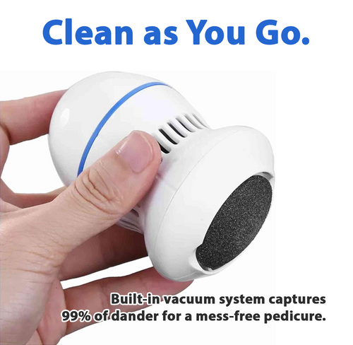 Vacuum Callus Remover