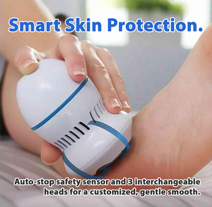 Vacuum Callus Remover